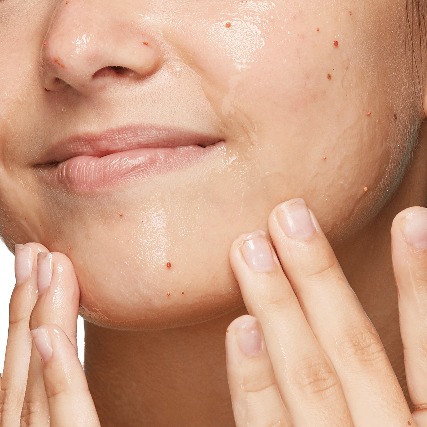 Femmes atteintes d'acné - Exfoliant antiacné Neutrogena