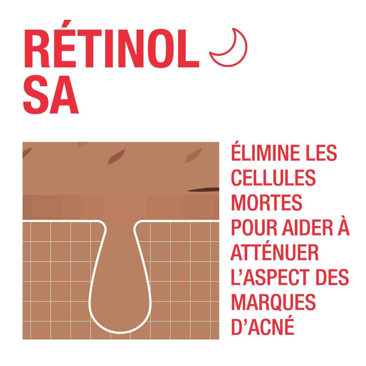 Image montrant comment le Retinol SA élimine les cellules mortes de la peau pour améliorer l'aspect des marques laissées par l'acné